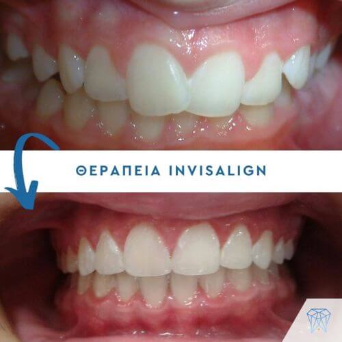 strava-mprosta-dontia