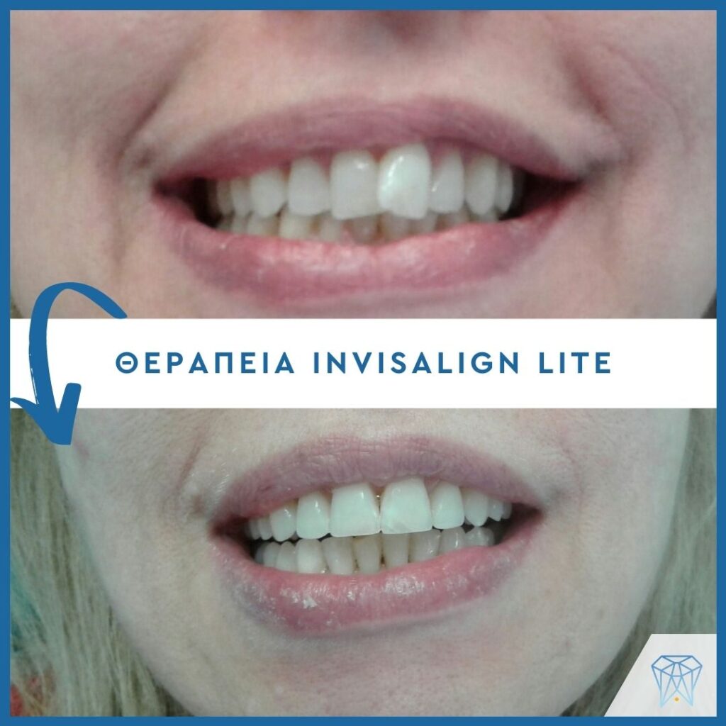 Strava-mprosta-dontia-1-1024x1024